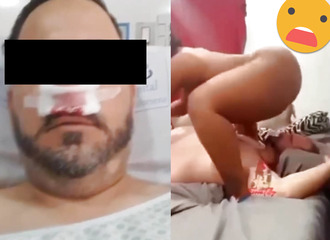 Find out how he broke his nose!